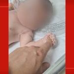 Médico do DF é condenado por homicídio culposo após morte de bebê horas depois do parto